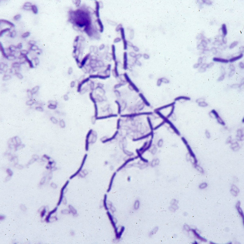 Сінна паличка або Bacillus subtilis